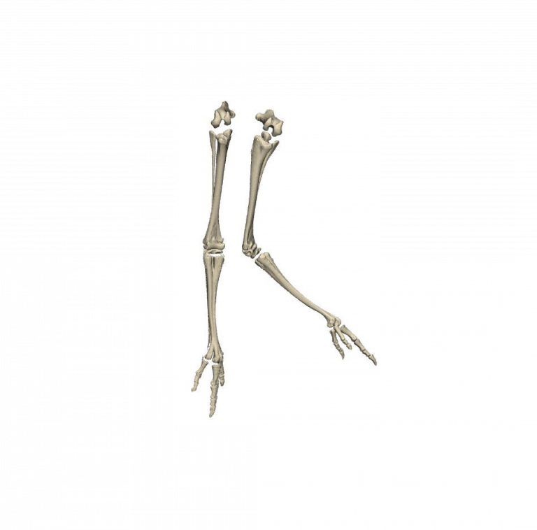 Ostrich Limb Deformity
